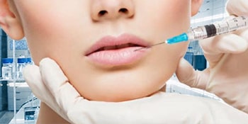 Dermal Fillers